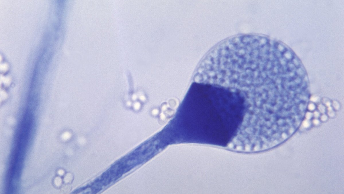 Image accompanying What is black fungus—and why is it spreading among India’s COVID patients?